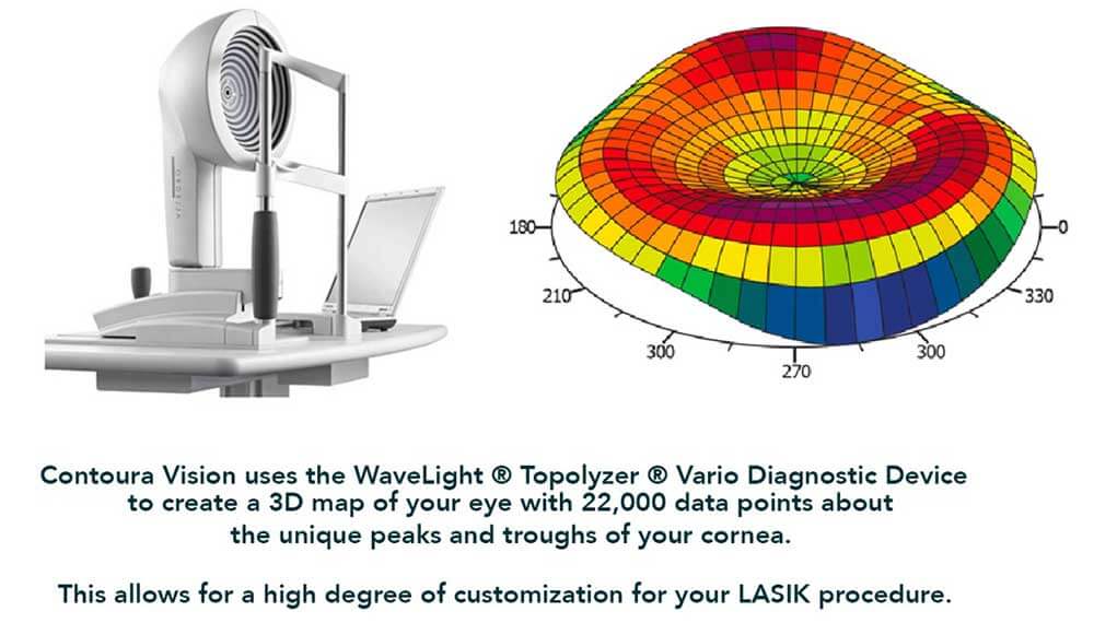 Contoura Lasik Treatment in Mumbai