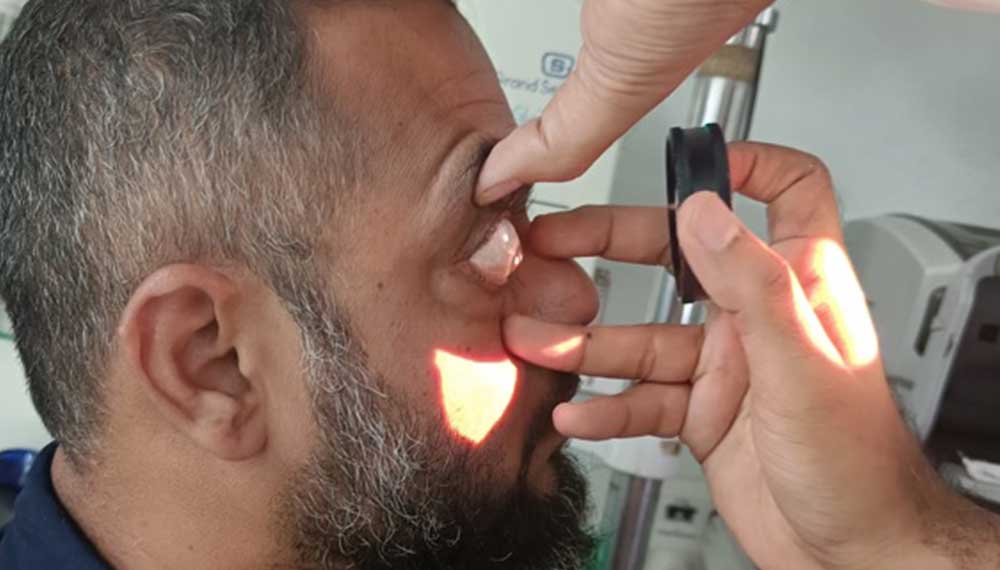 Keratoconus Specialist in Mumbai