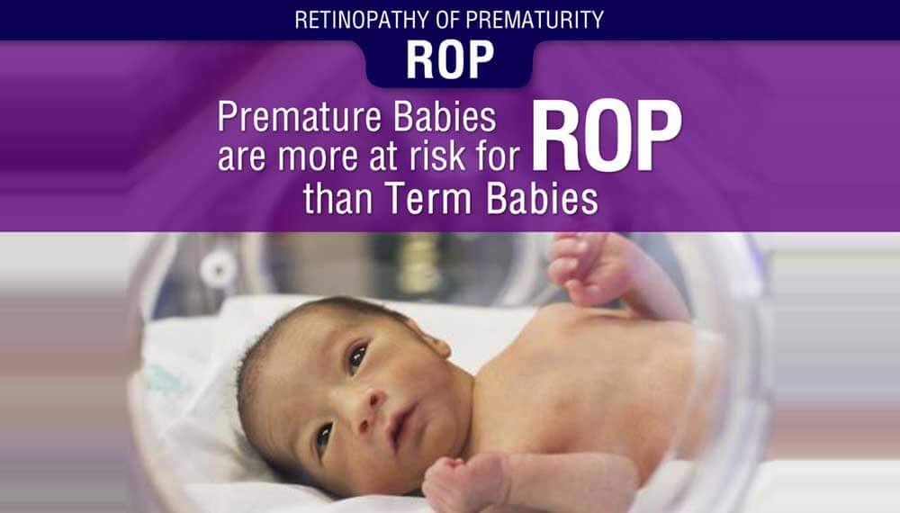 Retinopathy of Prematurity (ROP) Symptoms, Stages, Causes & Treatment Options